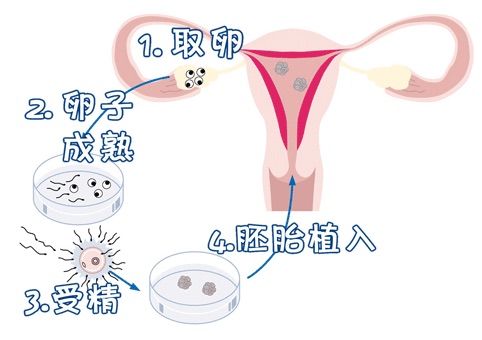 供卵代生咨询哪家靠谱